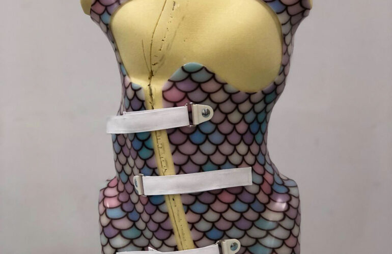 Escoliosis en niños – El corset ortopédico